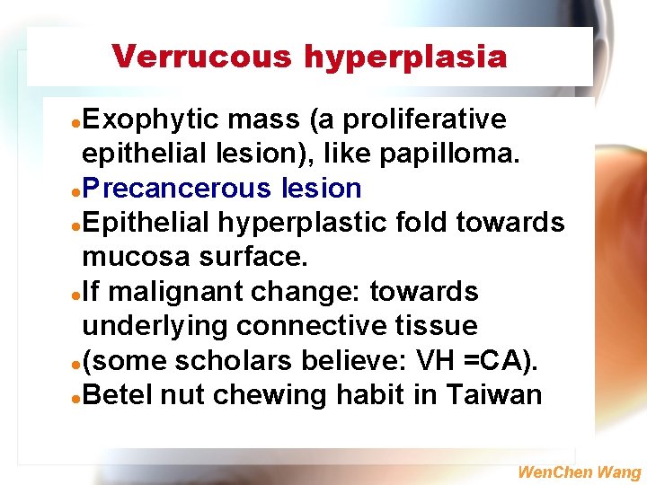Verrucous hyperplasia Exophytic mass (a proliferative epithelial lesion), like papilloma. l Precancerous lesion l