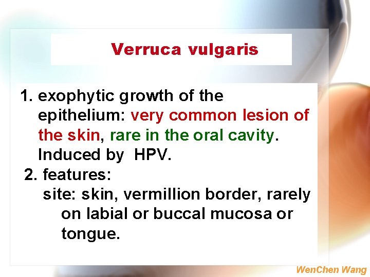 Verruca vulgaris 1. exophytic growth of the epithelium: very common lesion of the skin,