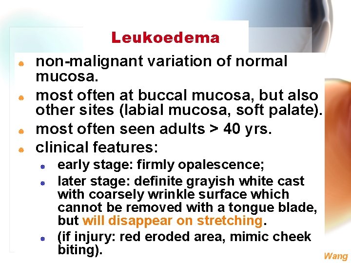 Leukoedema | | non-malignant variation of normal mucosa. most often at buccal mucosa, but