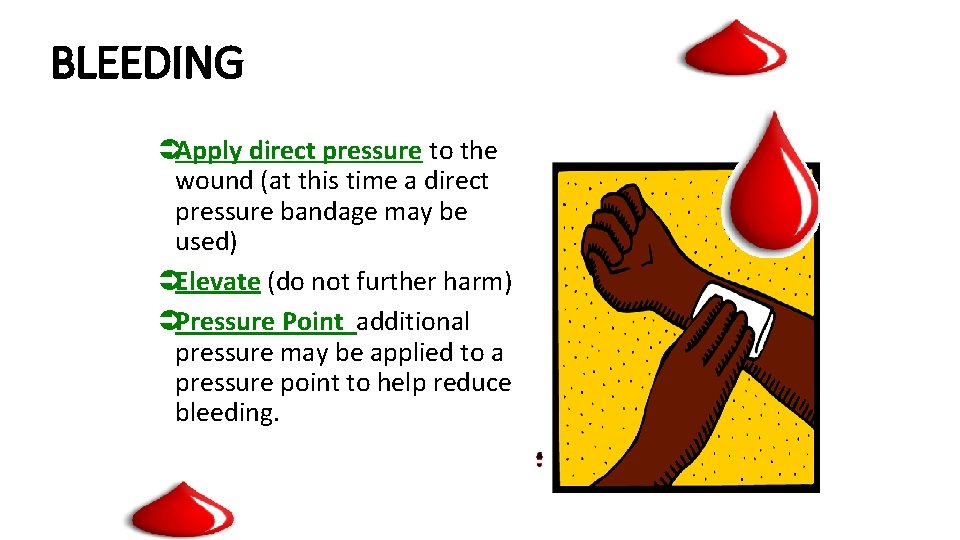 BLEEDING ÜApply direct pressure to the wound (at this time a direct pressure bandage