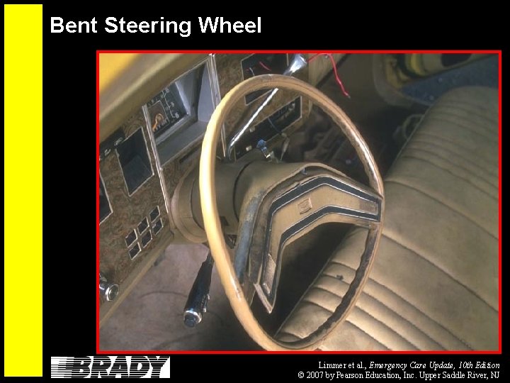 Bent Steering Wheel Limmer et al. , Emergency Care Update, 10 th Edition ©