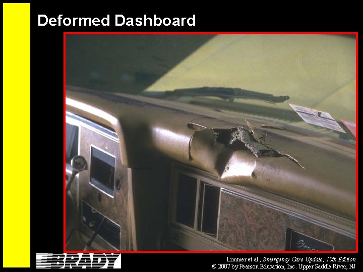 Deformed Dashboard Limmer et al. , Emergency Care Update, 10 th Edition © 2007