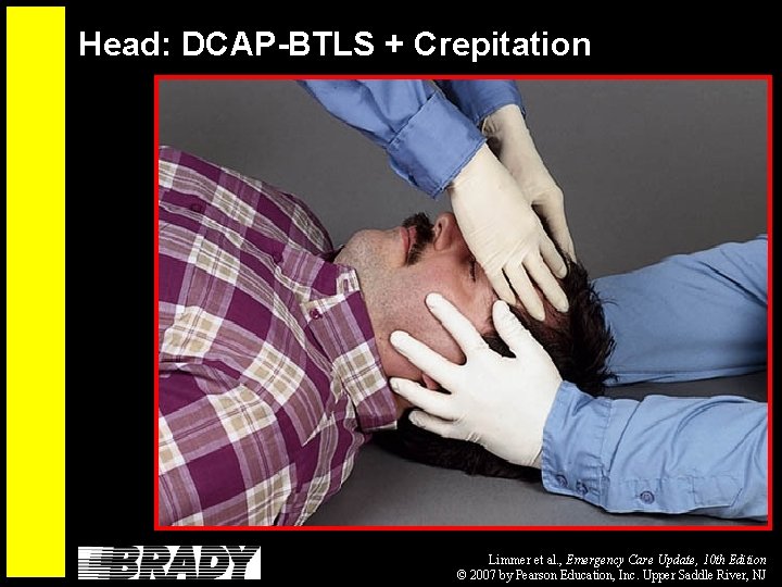 Head: DCAP-BTLS + Crepitation Limmer et al. , Emergency Care Update, 10 th Edition