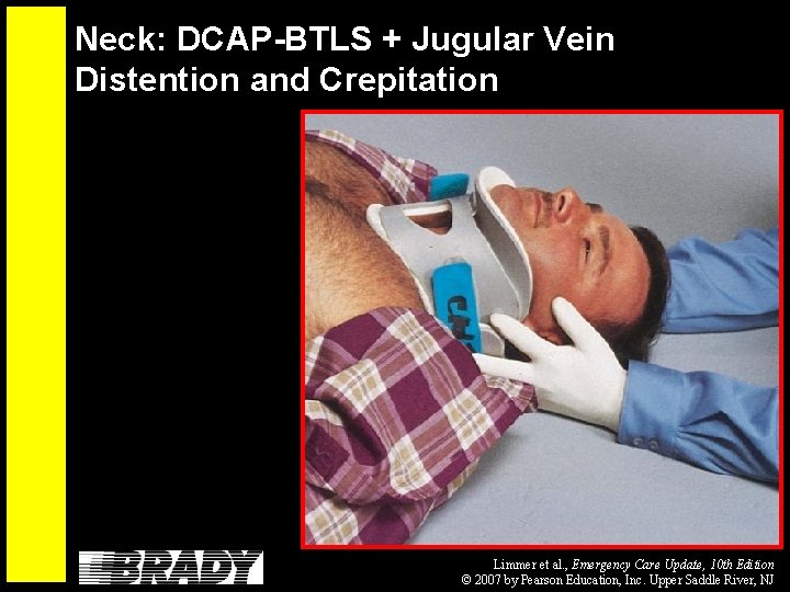 Neck: DCAP-BTLS + Jugular Vein Distention and Crepitation Limmer et al. , Emergency Care