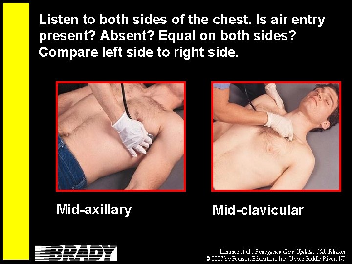 Listen to both sides of the chest. Is air entry present? Absent? Equal on