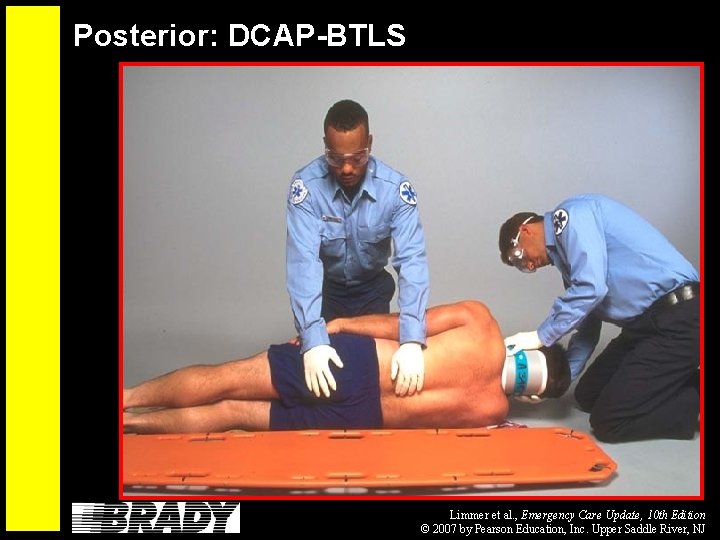 Posterior: DCAP-BTLS Limmer et al. , Emergency Care Update, 10 th Edition © 2007