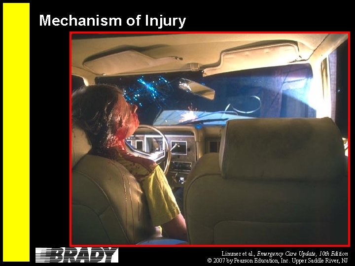Mechanism of Injury Limmer et al. , Emergency Care Update, 10 th Edition ©