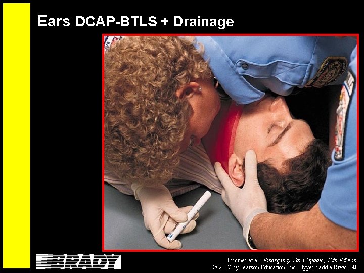 Ears DCAP-BTLS + Drainage Limmer et al. , Emergency Care Update, 10 th Edition