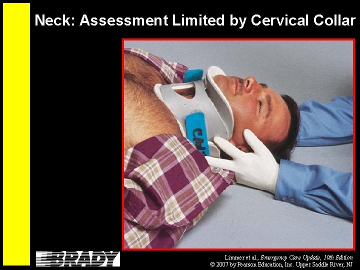 Neck: Assessment Limited by Cervical Collar Limmer et al. , Emergency Care Update, 10