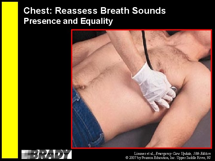 Chest: Reassess Breath Sounds Presence and Equality Limmer et al. , Emergency Care Update,