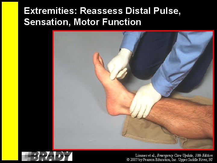 Extremities: Reassess Distal Pulse, Sensation, Motor Function Limmer et al. , Emergency Care Update,