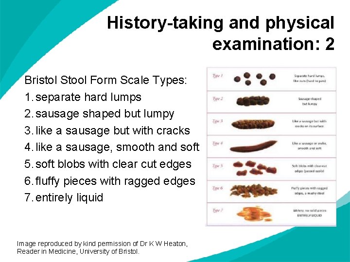 History-taking and physical examination: 2 Bristol Stool Form Scale Types: 1. separate hard lumps
