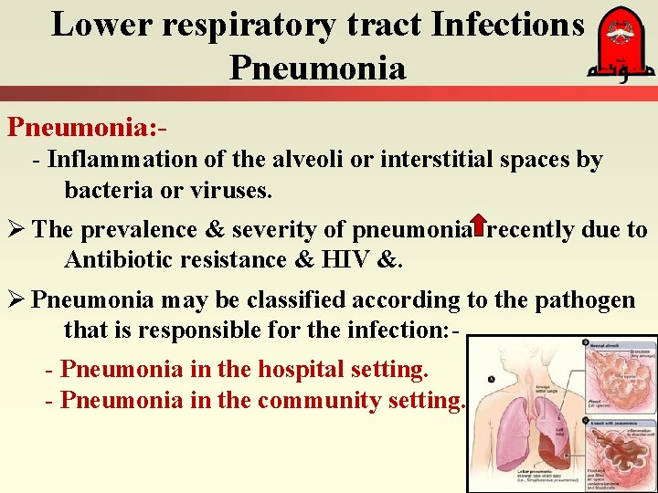 Lower respiratory tract Infections Pneumonia: - Inflammation of the alveoli or interstitial spaces by