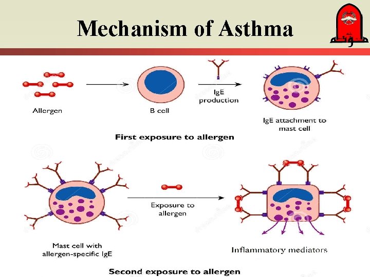 Mechanism of Asthma 