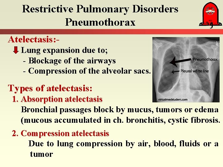 Restrictive Pulmonary Disorders Pneumothorax Atelectasis: Lung expansion due to; - Blockage of the airways