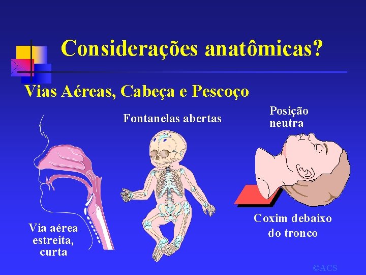 Considerações anatômicas? Vias Aéreas, Cabeça e Pescoço Fontanelas abertas Via aérea estreita, curta Posição