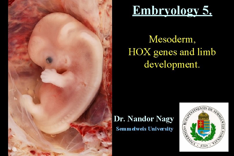 Embryology 5. Mesoderm, HOX genes and limb development. Dr. Nandor Nagy Semmelweis University 