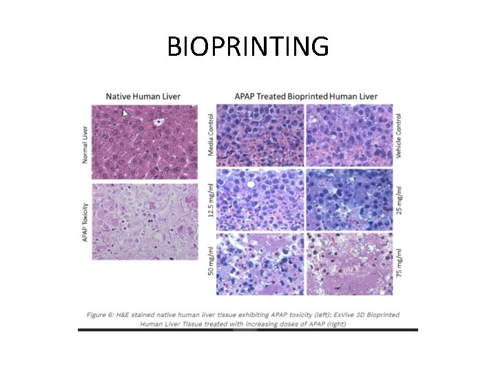 BIOPRINTING 