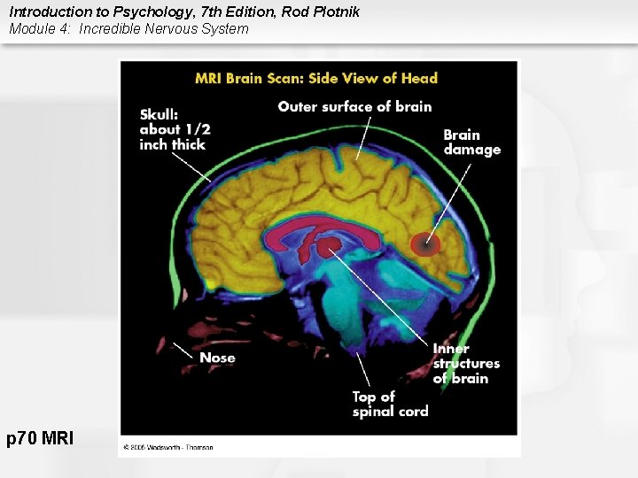 Introduction to Psychology, 7 th Edition, Rod Plotnik Module 4: Incredible Nervous System p