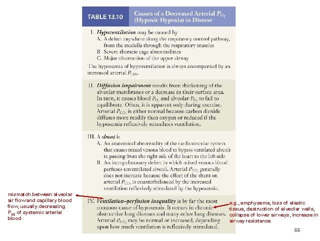 mismatch between alveolar air flow and capillary blood flow, usually decreasing PO 2 of mismatch between alveolar air flow and capillary blood flow, usually decreasing PO 2 of