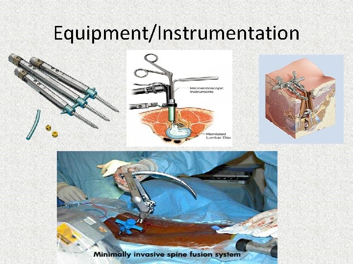 Equipment/Instrumentation 