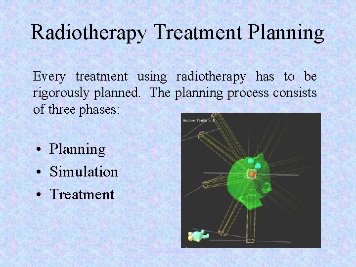 Radiotherapy Treatment Planning Every treatment using radiotherapy has to be rigorously planned. The planning