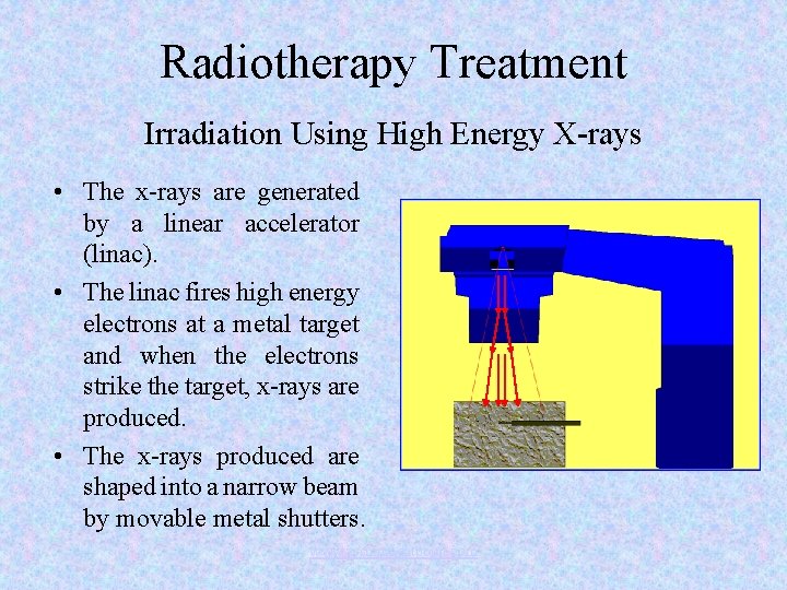 Radiotherapy Treatment Irradiation Using High Energy X-rays • The x-rays are generated by a