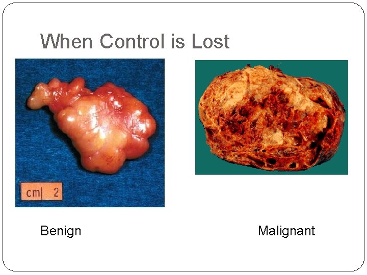 When Control is Lost Benign Malignant 