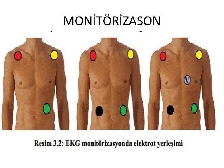 MONİTÖRİZASON 