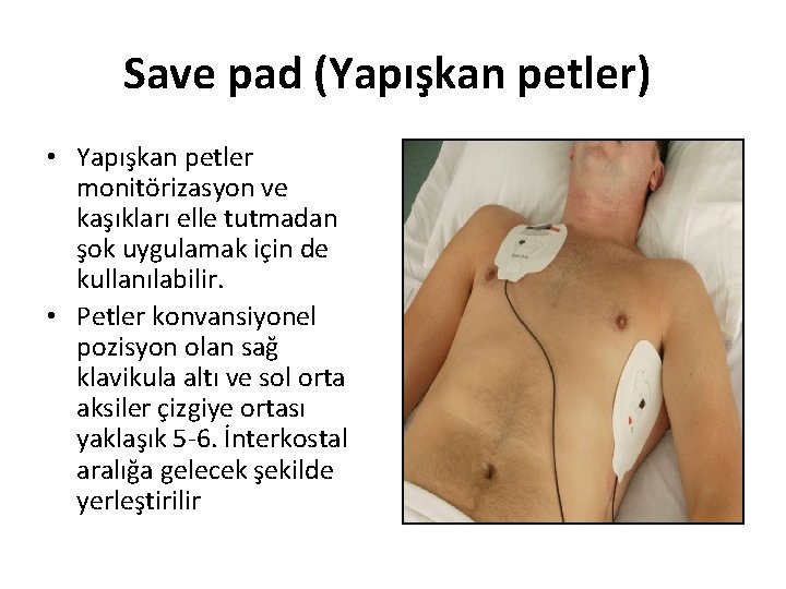 Save pad (Yapışkan petler) • Yapışkan petler monitörizasyon ve kaşıkları elle tutmadan şok uygulamak