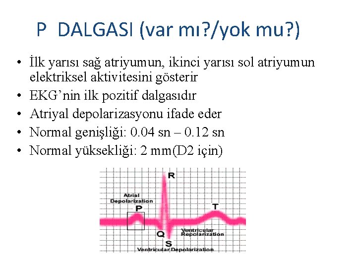 P DALGASI (var mı? /yok mu? ) • İlk yarısı sağ atriyumun, ikinci yarısı