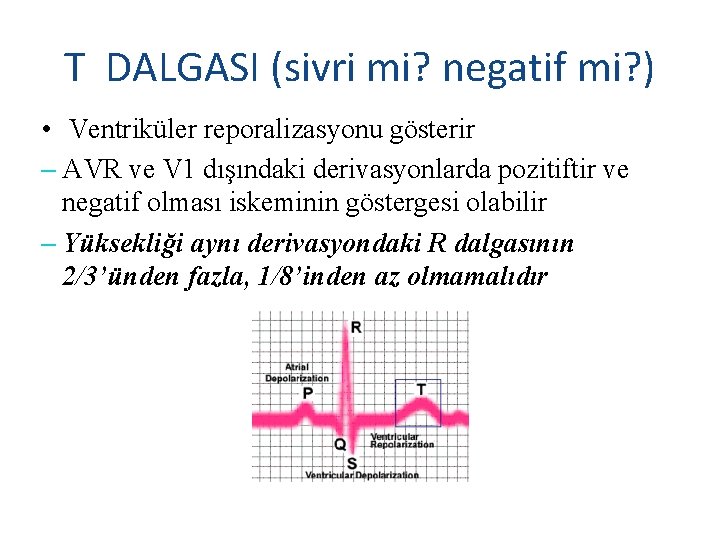 T DALGASI (sivri mi? negatif mi? ) • Ventriküler reporalizasyonu gösterir – AVR ve