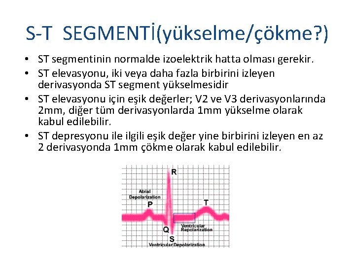 S-T SEGMENTİ(yükselme/çökme? ) • ST segmentinin normalde izoelektrik hatta olması gerekir. • ST elevasyonu,