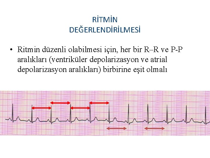 RİTMİN DEĞERLENDİRİLMESİ • Ritmin düzenli olabilmesi için, her bir R–R ve P-P aralıkları (ventriküler