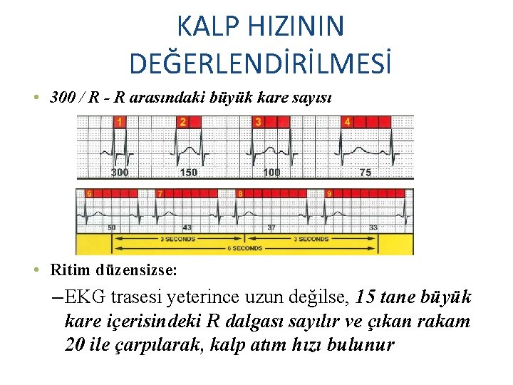 KALP HIZININ DEĞERLENDİRİLMESİ • 300 / R - R arasındaki büyük kare sayısı •