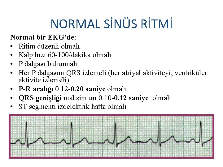 NORMAL SİNÜS RİTMİ Normal bir EKG’de: • Ritim düzenli olmalı • Kalp hızı 60