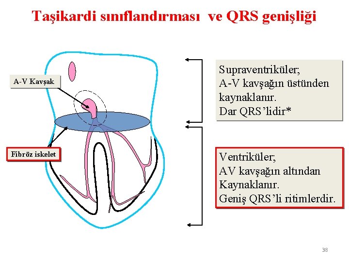 Taşikardi sınıflandırması ve QRS genişliği A-V Kavşak Fibröz iskelet Supraventriküler; A-V kavşağın üstünden kaynaklanır.