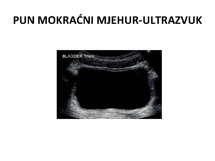 PUN MOKRAĆNI MJEHUR-ULTRAZVUK 