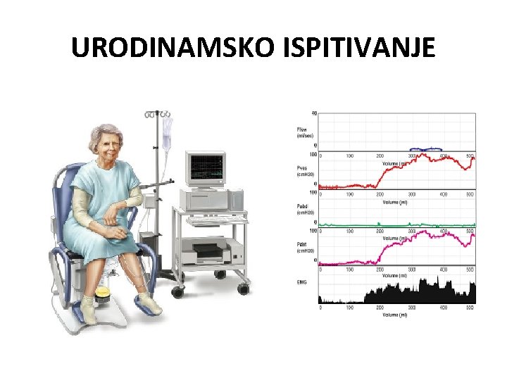 URODINAMSKO ISPITIVANJE 