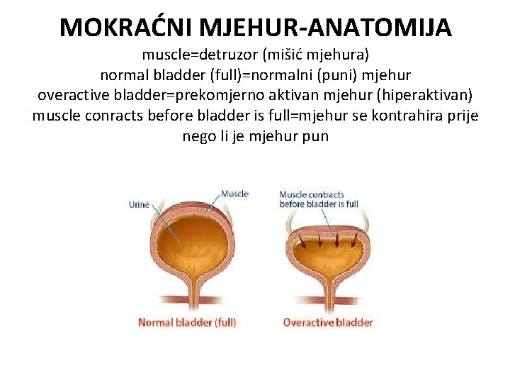 MOKRAĆNI MJEHUR-ANATOMIJA muscle=detruzor (mišić mjehura) normal bladder (full)=normalni (puni) mjehur overactive bladder=prekomjerno aktivan mjehur