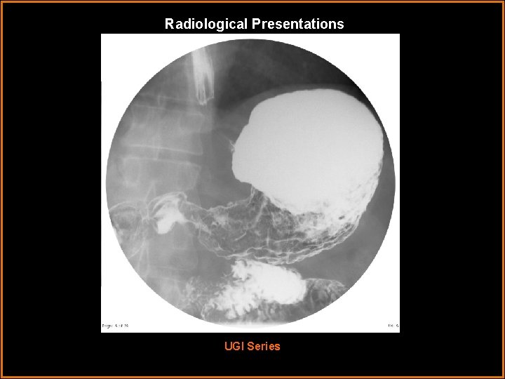 Radiological Presentations UGI Series 