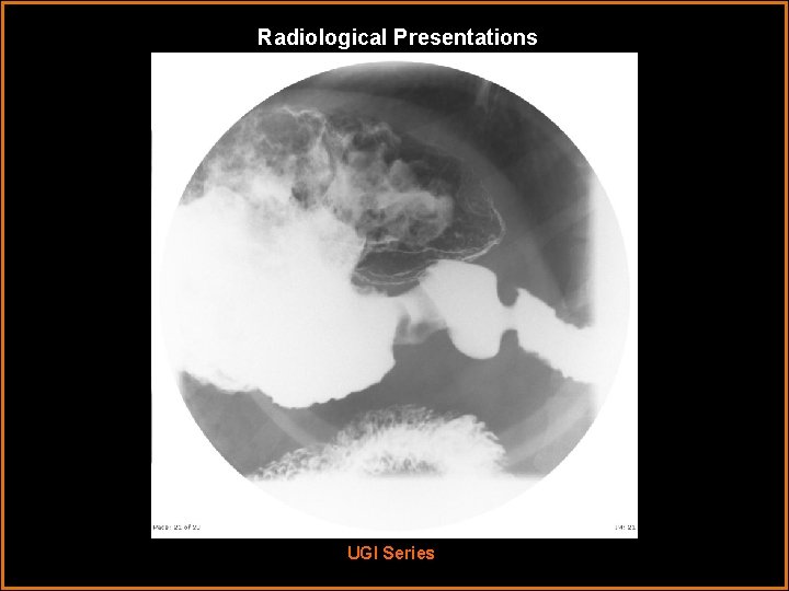 Radiological Presentations UGI Series 