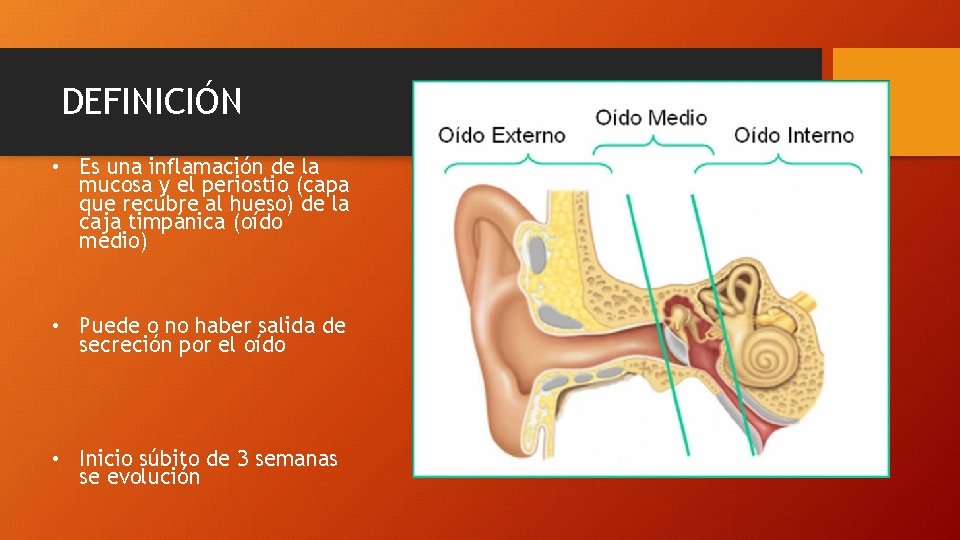 DEFINICIÓN • Es una inflamación de la mucosa y el periostio (capa que recubre