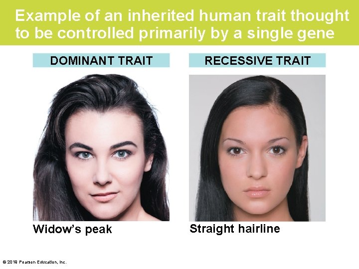 Example of an inherited human trait thought to be controlled primarily by a single