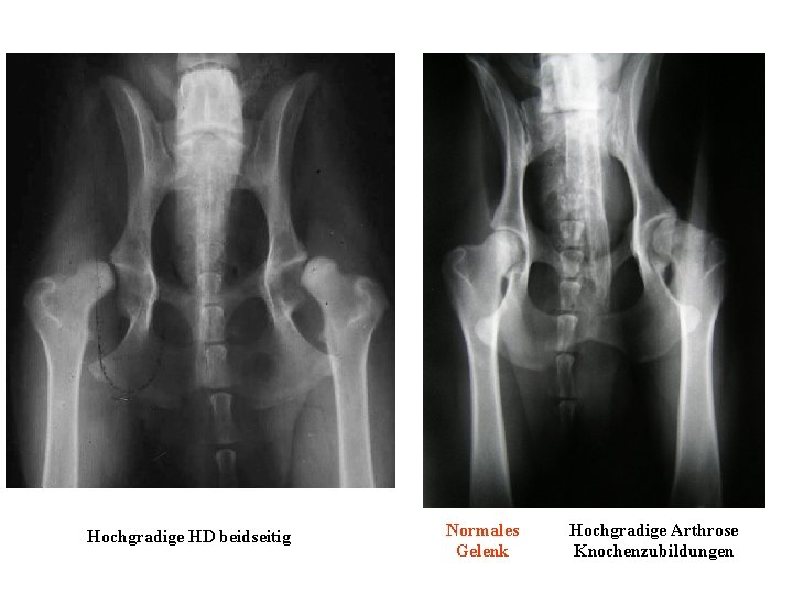 Hochgradige HD beidseitig Normales Gelenk Hochgradige Arthrose Knochenzubildungen 