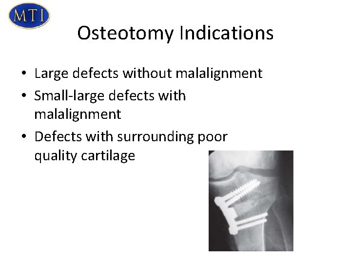 Osteotomy Indications • Large defects without malalignment • Small-large defects with malalignment • Defects