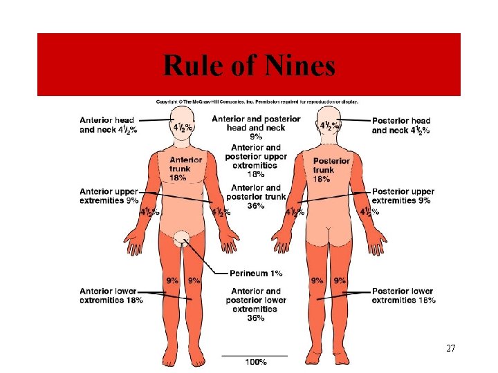 Rule of Nines 27 
