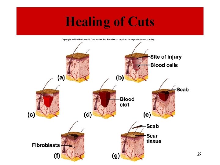 Healing of Cuts 29 
