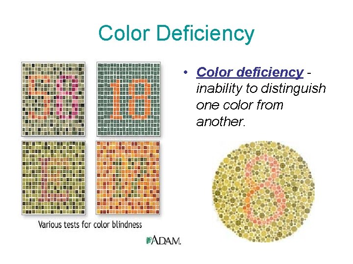 Color Deficiency • Color deficiency inability to distinguish one color from another. 