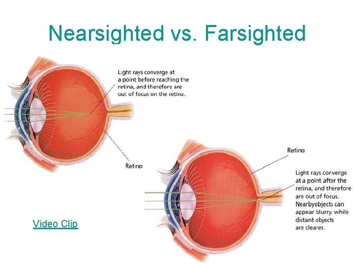 Nearsighted vs. Farsighted Video Clip 